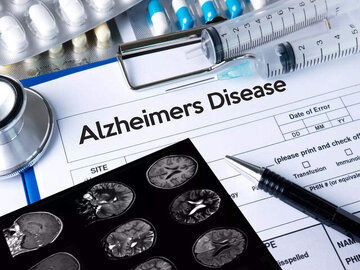 دارو موثر برای بیماری آلزایمر